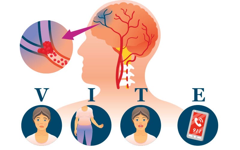 Illustration of the brain